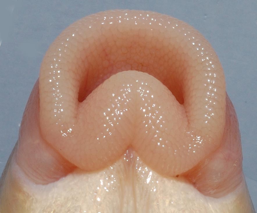 Moxostoma pappillosum lips